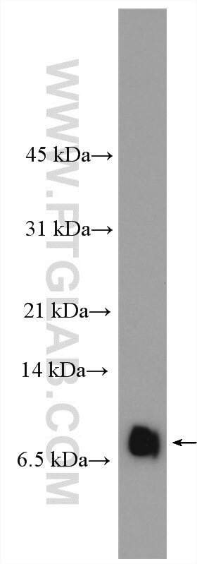 Western Blot (WB) analysis of human peripheral blood platelets using RANTES Polyclonal antibody (12000-1-AP)
