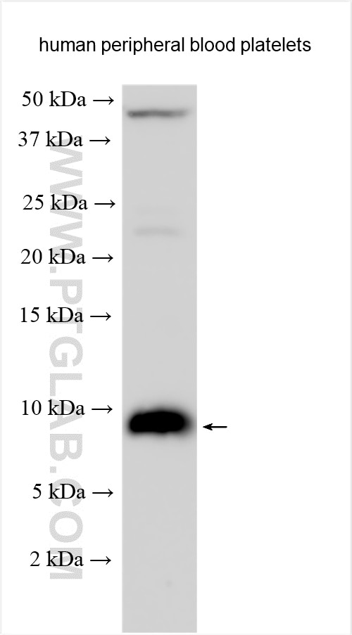 Western Blot (WB) analysis of various lysates using RANTES Polyclonal antibody (12000-1-AP)