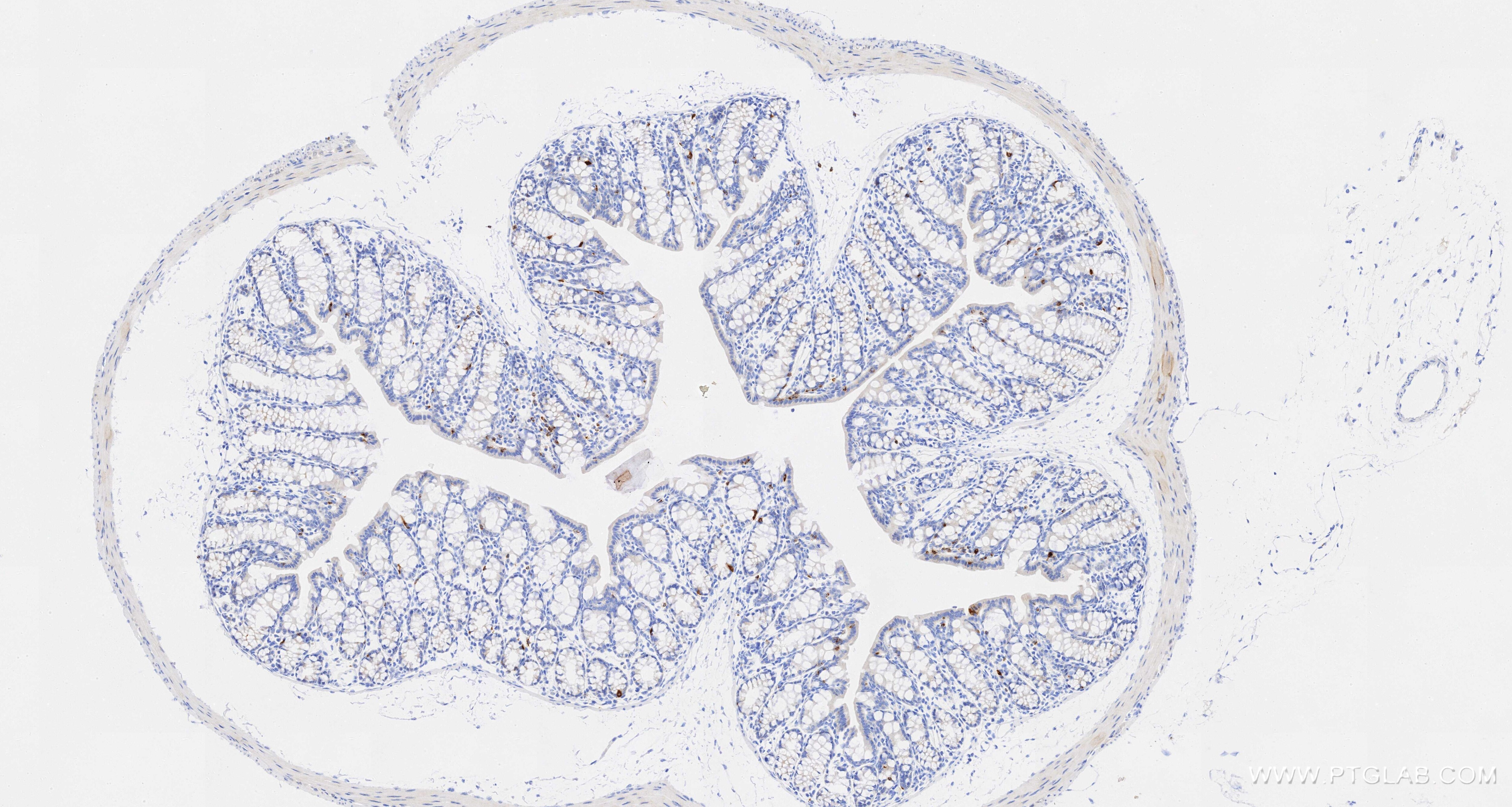 Immunohistochemistry (IHC) staining of mouse colon tissue using CCL5 Recombinant monoclonal antibody (87060-4-RR)