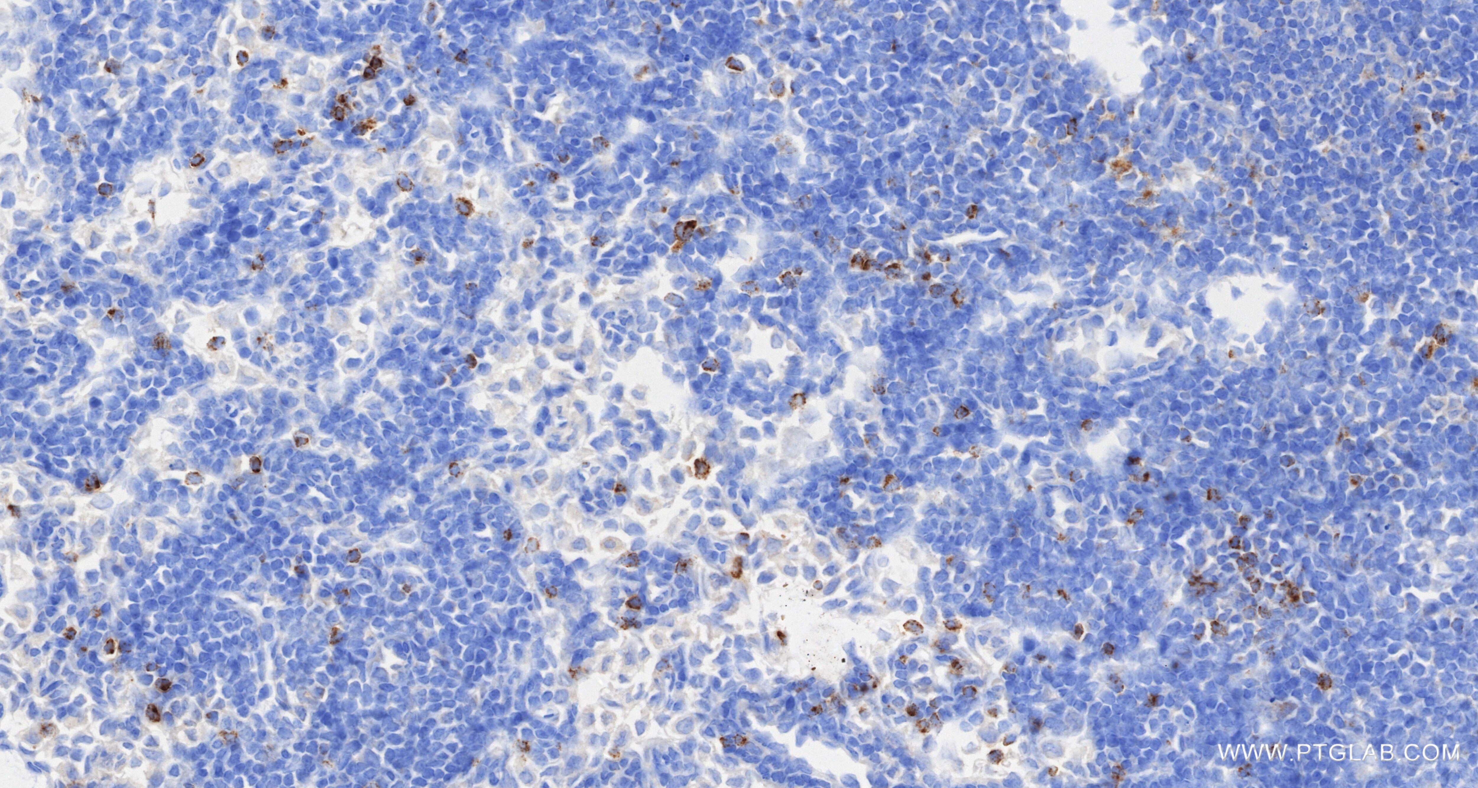 Immunohistochemistry (IHC) staining of mouse colon tissue using CCL5 Recombinant monoclonal antibody (87060-4-RR)