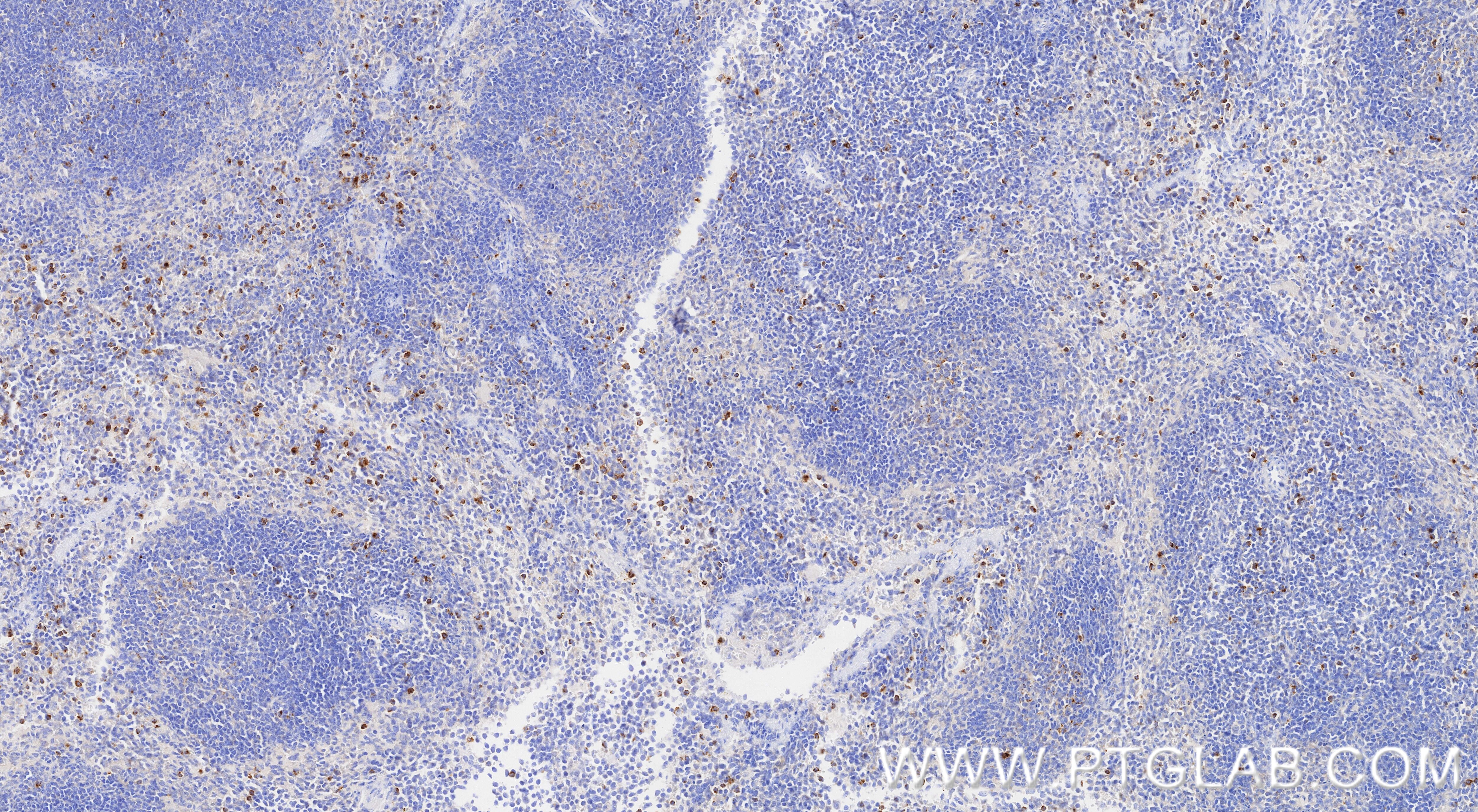 Immunohistochemistry (IHC) staining of mouse spleen tissue using CCL5 Recombinant monoclonal antibody (87060-4-RR)