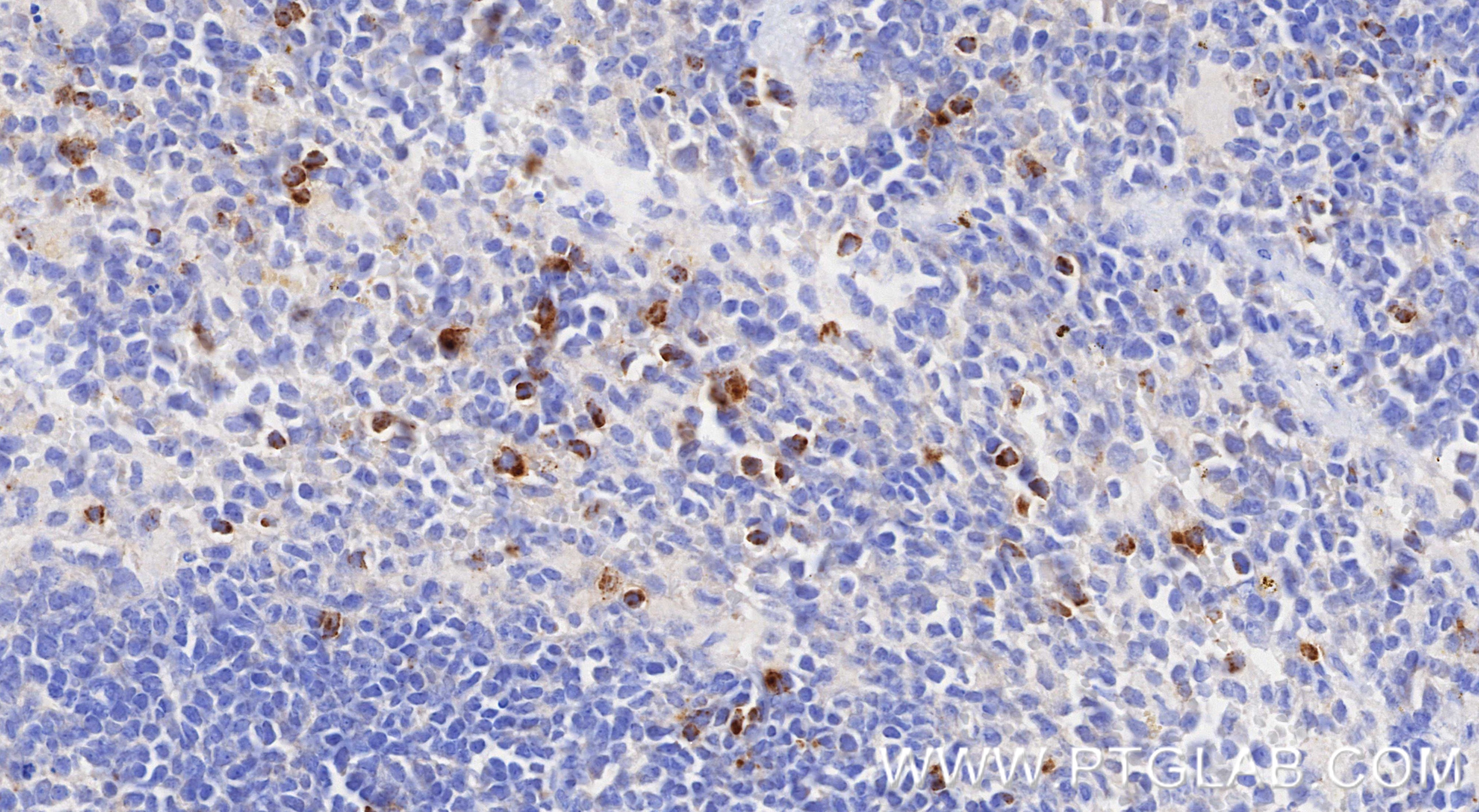 Immunohistochemistry (IHC) staining of mouse spleen tissue using CCL5 Recombinant monoclonal antibody (87060-4-RR)