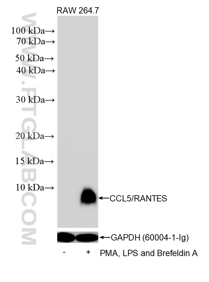 WB analysis using 87060-4-RR (same clone as 87060-4-PBS) Western Blot (WB) analysis of various lysates using CCL5 Recombinant monoclonal antibody (87060-4-RR)