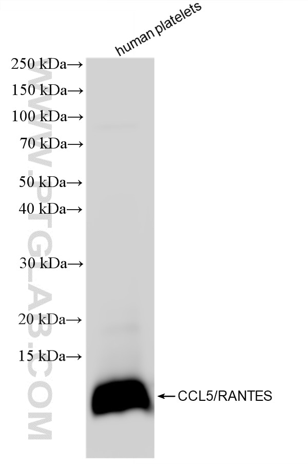 WB analysis of human peripheral blood platelets using 88173-1-RR Western Blot (WB) analysis of human peripheral blood platelets using CCL5/RANTES Recombinant monoclonal antibody (88173-1-RR)