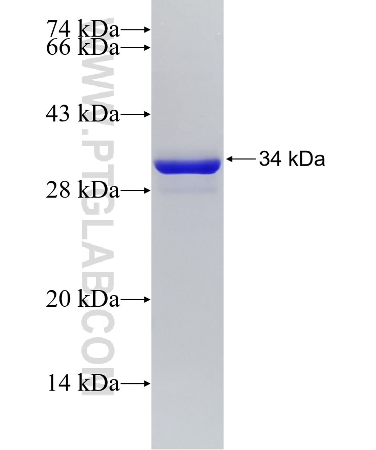 CCL8 fusion protein Ag18010 SDS-PAGE