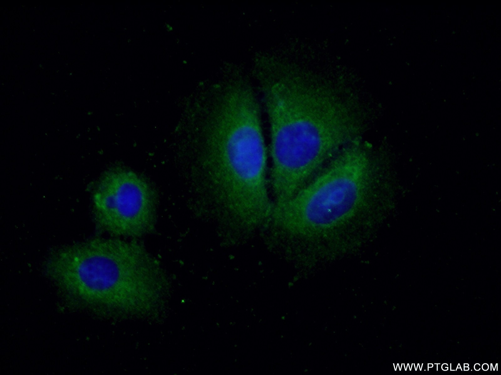 Immunofluorescence (IF) / fluorescent staining of MCF-7 cells using CCM2 Polyclonal antibody (26270-1-AP)