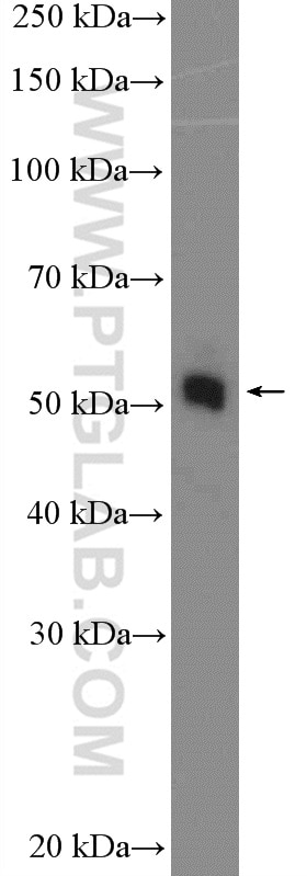 Western Blot (WB) analysis of MCF-7 cells using CCM2 Polyclonal antibody (26270-1-AP)