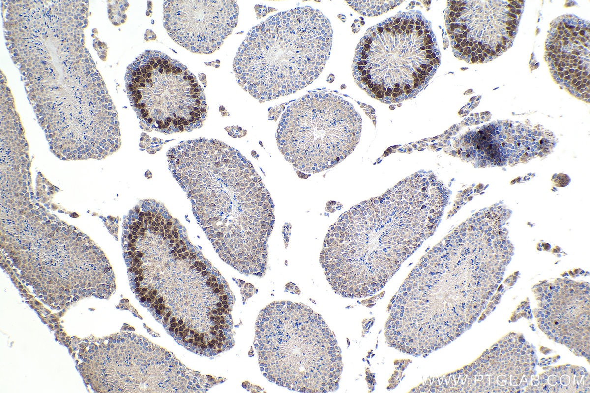 Immunohistochemistry (IHC) staining of mouse testis tissue using Cyclin A1 Polyclonal antibody (13295-1-AP)