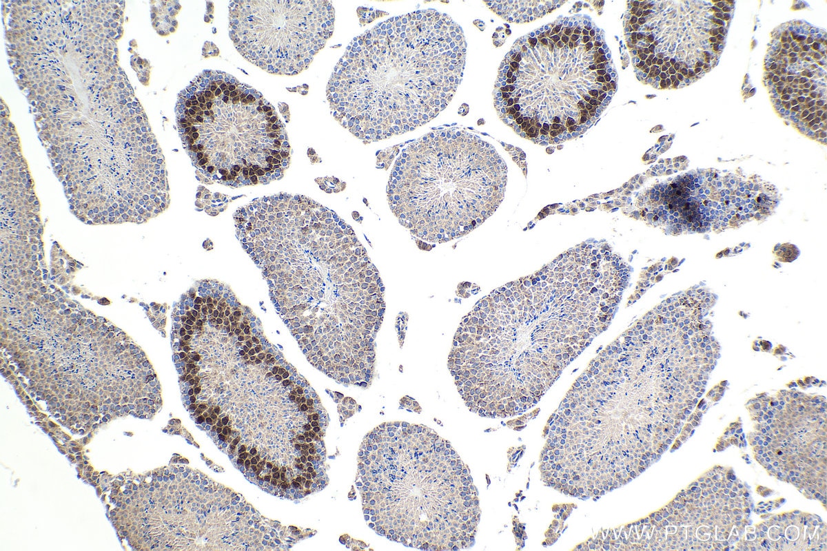 IHC staining of mouse testis using 13295-1-AP