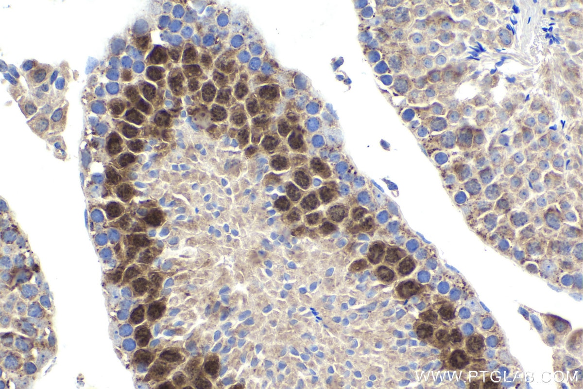 Immunohistochemistry (IHC) staining of mouse testis tissue using Cyclin A1 Polyclonal antibody (13295-1-AP)