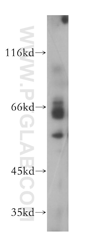 Western Blot (WB) analysis of U-937 cells using Cyclin A1 Polyclonal antibody (13295-1-AP)