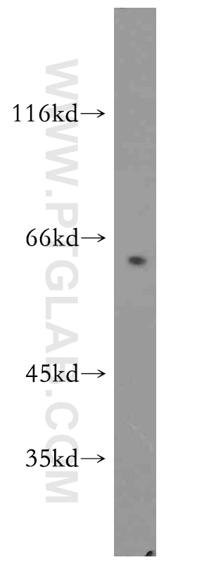 Western Blot (WB) analysis of human testis tissue using Cyclin A1 Polyclonal antibody (13295-1-AP)