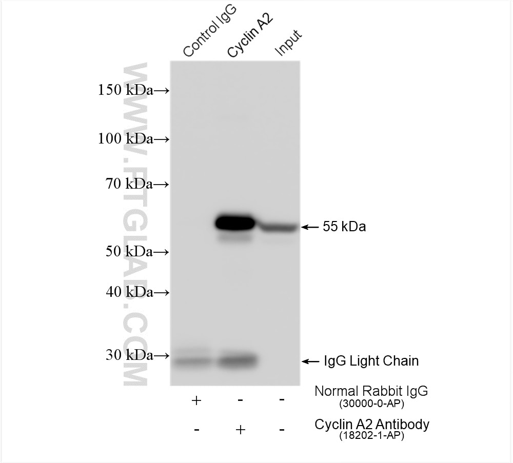 Immunoprecipitation (IP) experiment of HeLa cells using Cyclin A2 Polyclonal antibody (18202-1-AP)