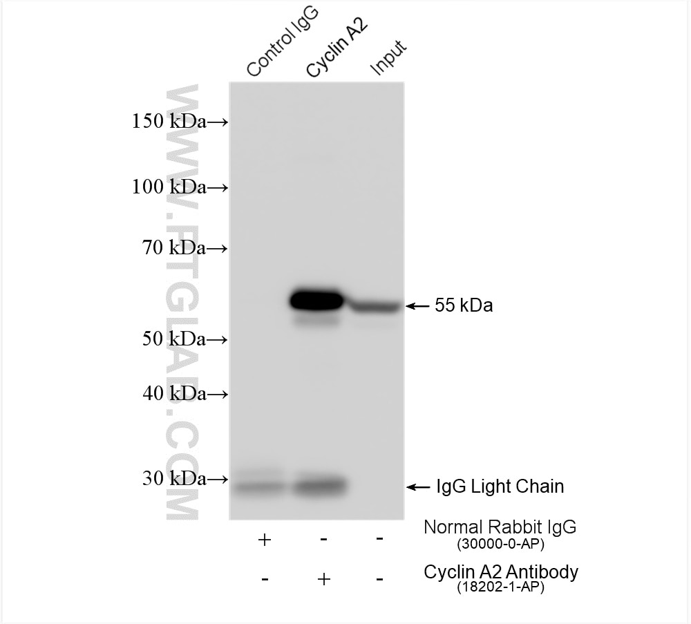 IP experiment of HeLa using 18202-1-AP