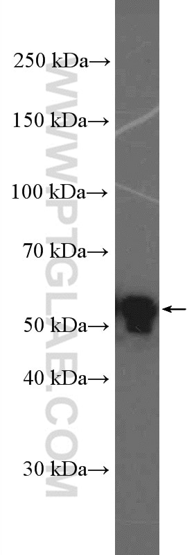 Western Blot (WB) analysis of MCF-7 cells using Cyclin A2 Polyclonal antibody (18202-1-AP)