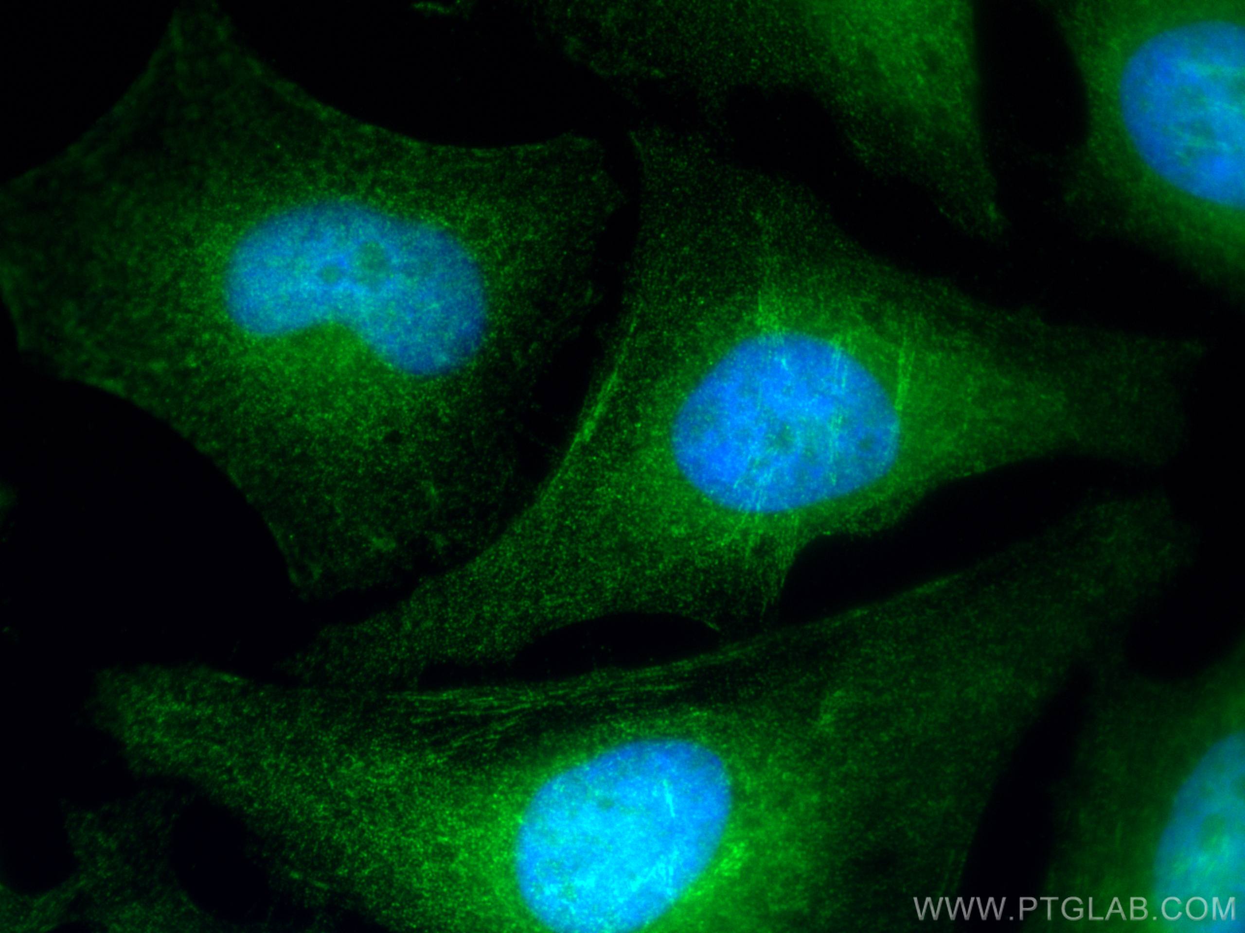Immunofluorescence (IF) / fluorescent staining of HeLa cells using Cyclin B1 Polyclonal antibody (55004-1-AP)