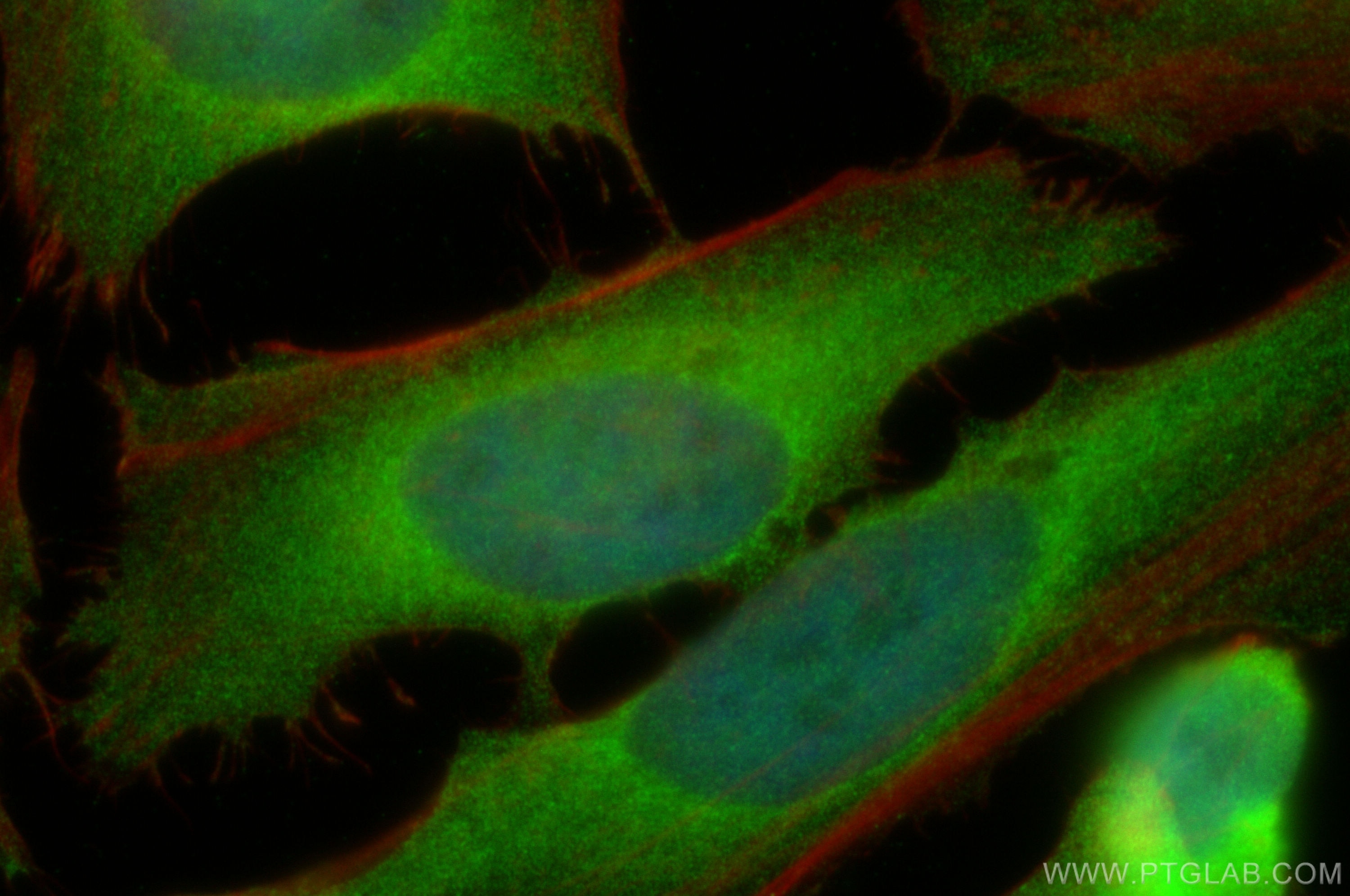 Immunofluorescence (IF) / fluorescent staining of HeLa cells using Cyclin B1 Polyclonal antibody (55004-1-AP)