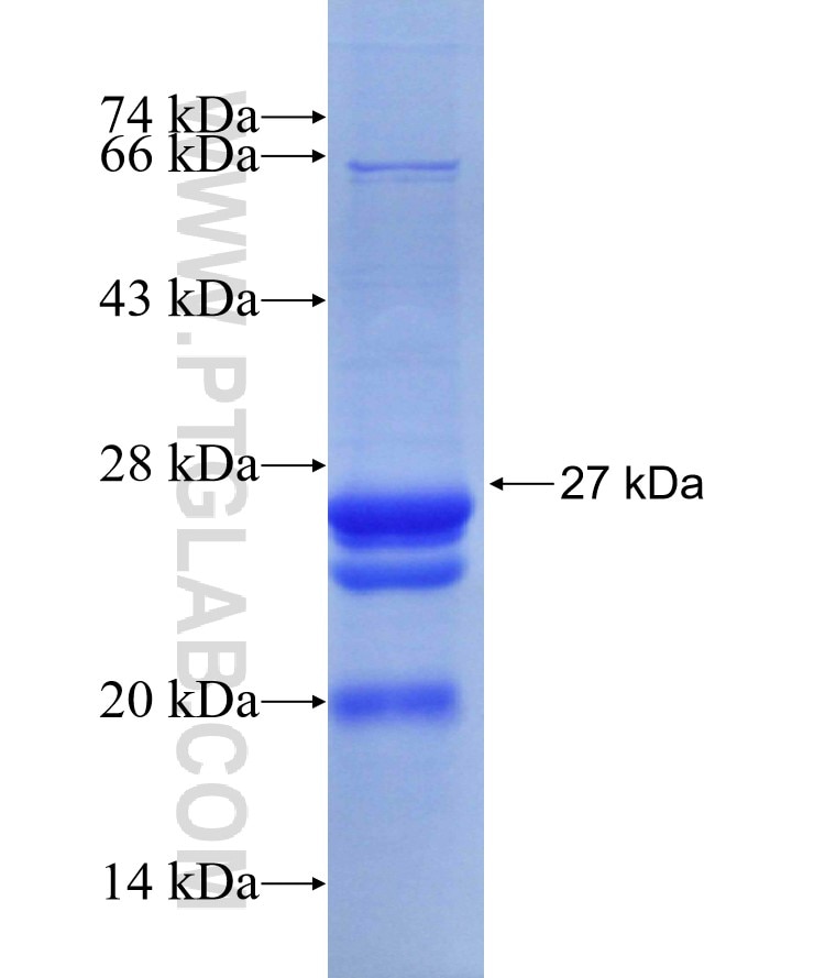 CCNB1 fusion protein Ag29444 SDS-PAGE