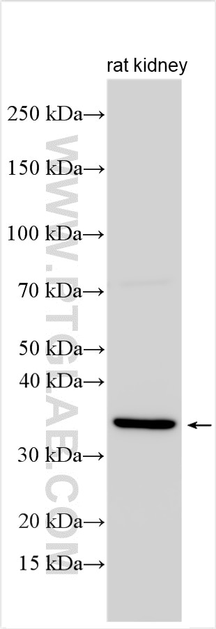 Rat kidney lysate was subjected to SDS PAGE followed by western blot with 33150-1-AP (CCNB1IP1 antibody) at dilution of 1:1500 incubated at room temperature for 1.5 hours. This data was developed using the same antibody clone with 33150-1-PBS in a different storage buffer formulation. Western Blot (WB) analysis of various lysates using CCNB1IP1 Polyclonal antibody (33150-1-AP)
