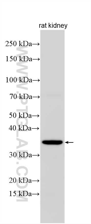 WB analysis using 33150-1-AP Western Blot (WB) analysis of various lysates using CCNB1IP1 Polyclonal antibody (33150-1-AP)