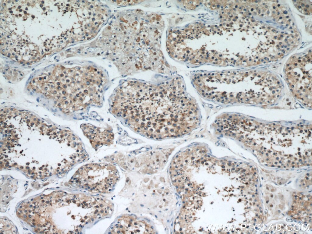 Immunohistochemistry (IHC) staining of human testis tissue using Cyclin B2 Polyclonal antibody (21644-1-AP)