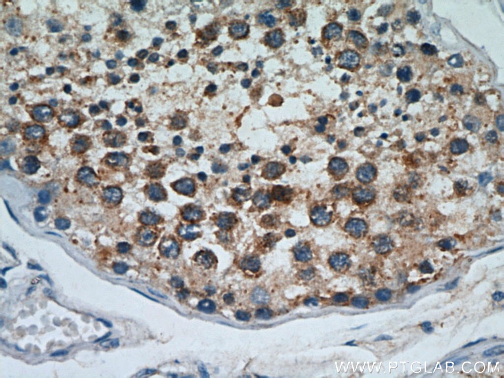 Immunohistochemistry (IHC) staining of human testis tissue using Cyclin B2 Polyclonal antibody (21644-1-AP)