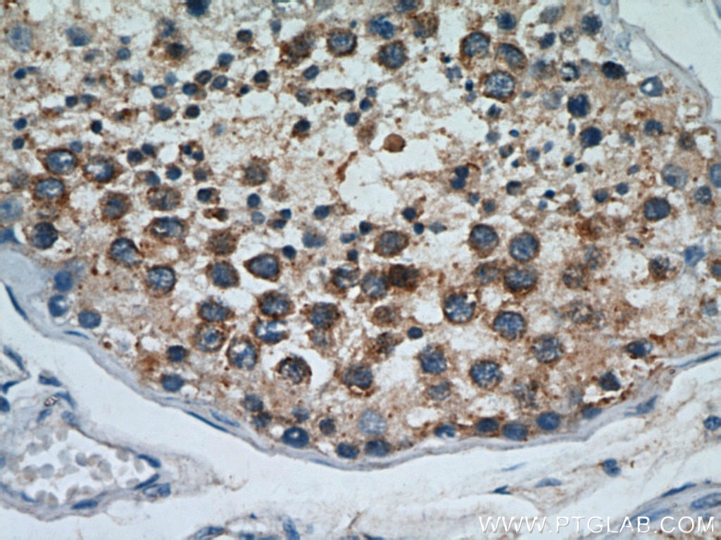 IHC staining of human testis using 21644-1-AP