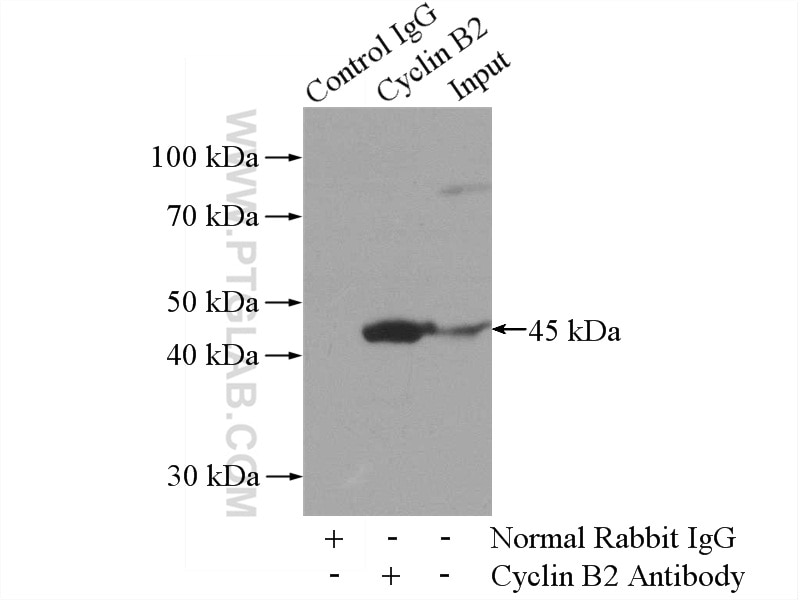 Immunoprecipitation (IP) experiment of A431 cells using Cyclin B2 Polyclonal antibody (21644-1-AP)