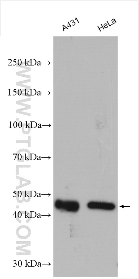 Western Blot (WB) analysis of various lysates using Cyclin B2 Polyclonal antibody (21644-1-AP)