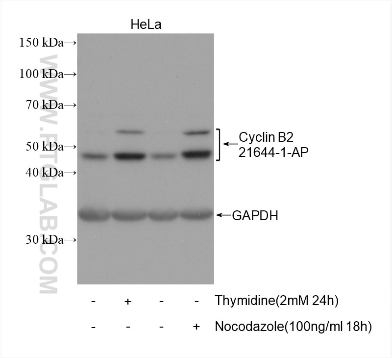 WB analysis of HeLa using 21644-1-AP