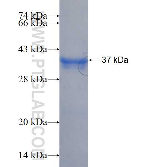 CCNB2 fusion protein Ag16716 SDS-PAGE