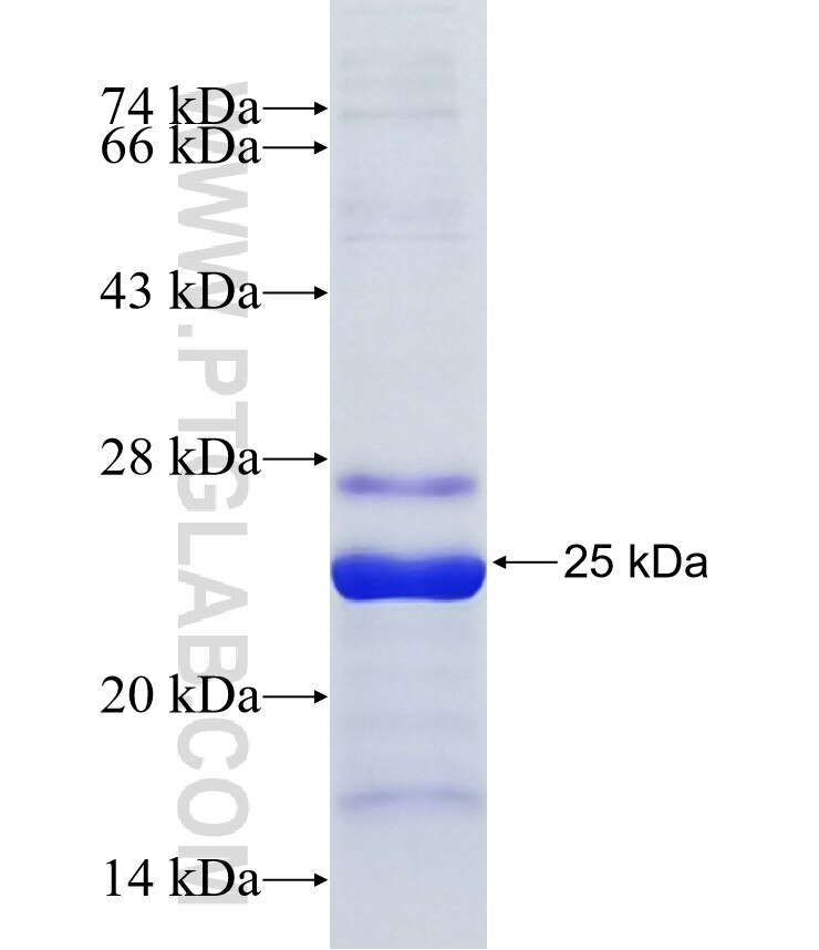 CCNB3 fusion protein Ag36851 SDS-PAGE