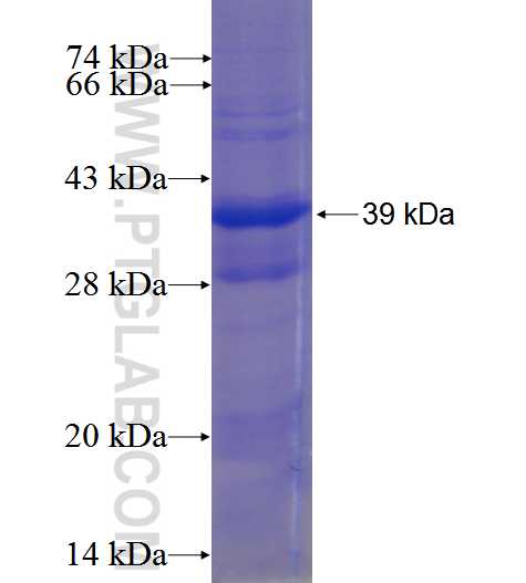 CCNC fusion protein Ag23955 SDS-PAGE