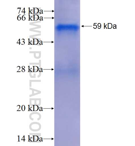 CCNC fusion protein Ag5969 SDS-PAGE