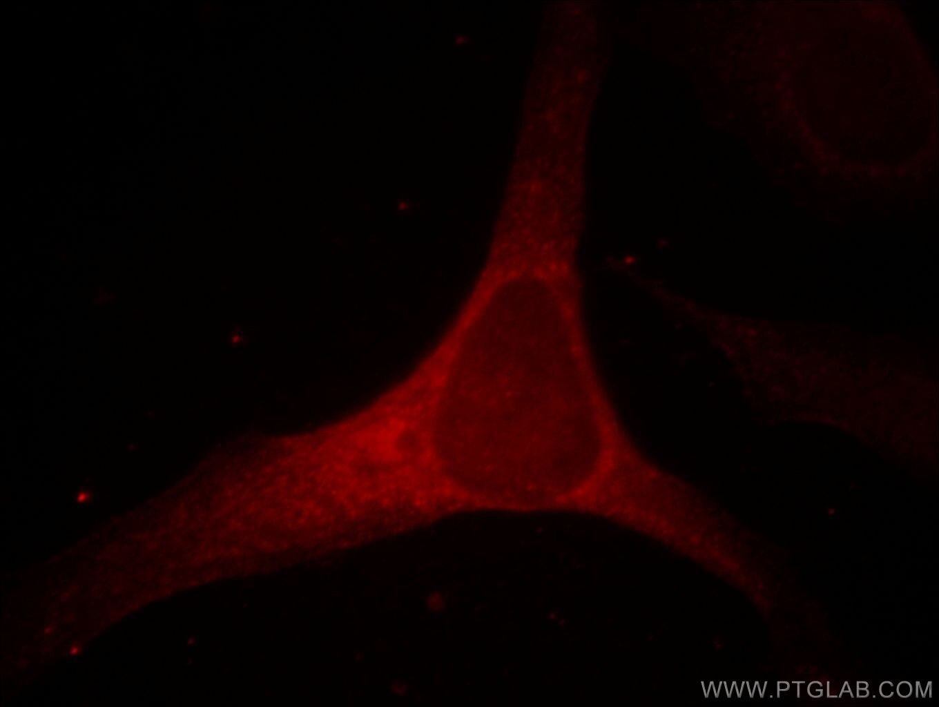 Cyclin D1 Monoclonal antibody