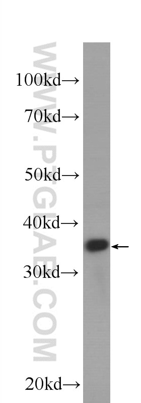 Western Blot (WB) analysis of A549 cells using Cyclin D1 Monoclonal antibody (60186-1-Ig)