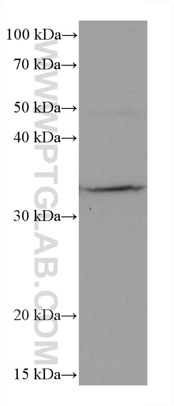 Western Blot (WB) analysis of RAW 264.7 cells using Cyclin D1 Monoclonal antibody (60186-1-Ig)