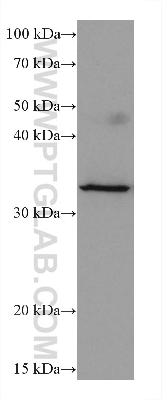 Western Blot (WB) analysis of MCF-7 cells using Cyclin D1 Monoclonal antibody (60186-1-Ig)