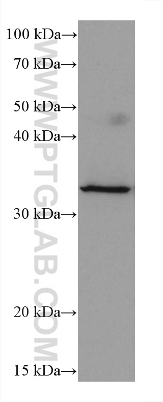 WB analysis of MCF-7 using 60186-1-Ig