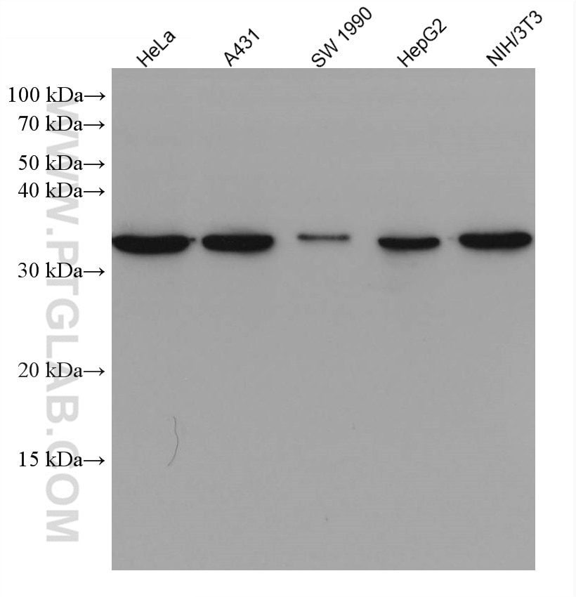 Western Blot (WB) analysis of various lysates using Cyclin D1 Monoclonal antibody (60186-1-Ig)