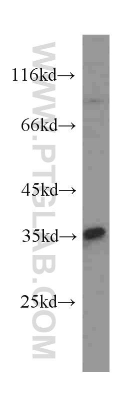 Western Blot (WB) analysis of SH-SY5Y cells using Cyclin D1 Monoclonal antibody (60186-1-Ig)