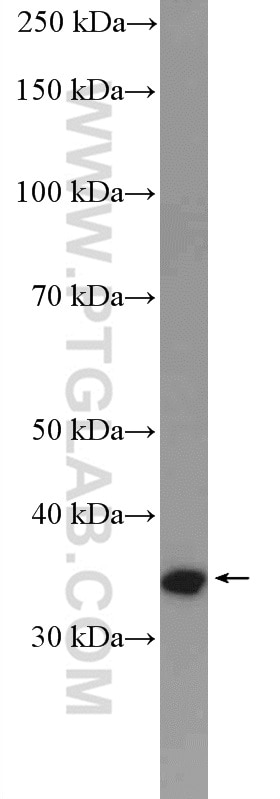 Western Blot (WB) analysis of MCF-7 cells using Cyclin D2 Polyclonal antibody (10934-1-AP)