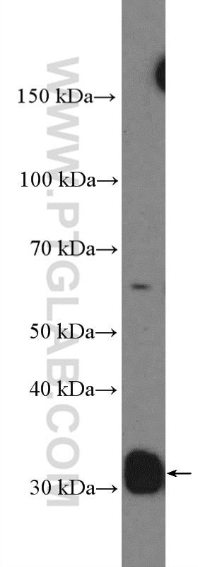 Western Blot (WB) analysis of NIH/3T3 cells using Cyclin D2 Polyclonal antibody (10934-1-AP)