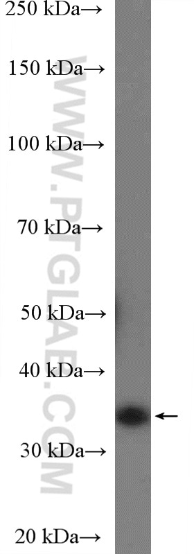 Western Blot (WB) analysis of MCF-7 cells using Cyclin D2 Polyclonal antibody (10934-1-AP)