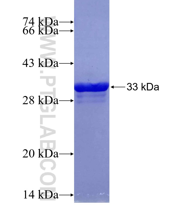 CCND2 fusion protein Ag29711 SDS-PAGE