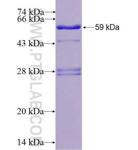 CCND2 fusion protein Ag1377 SDS-PAGE