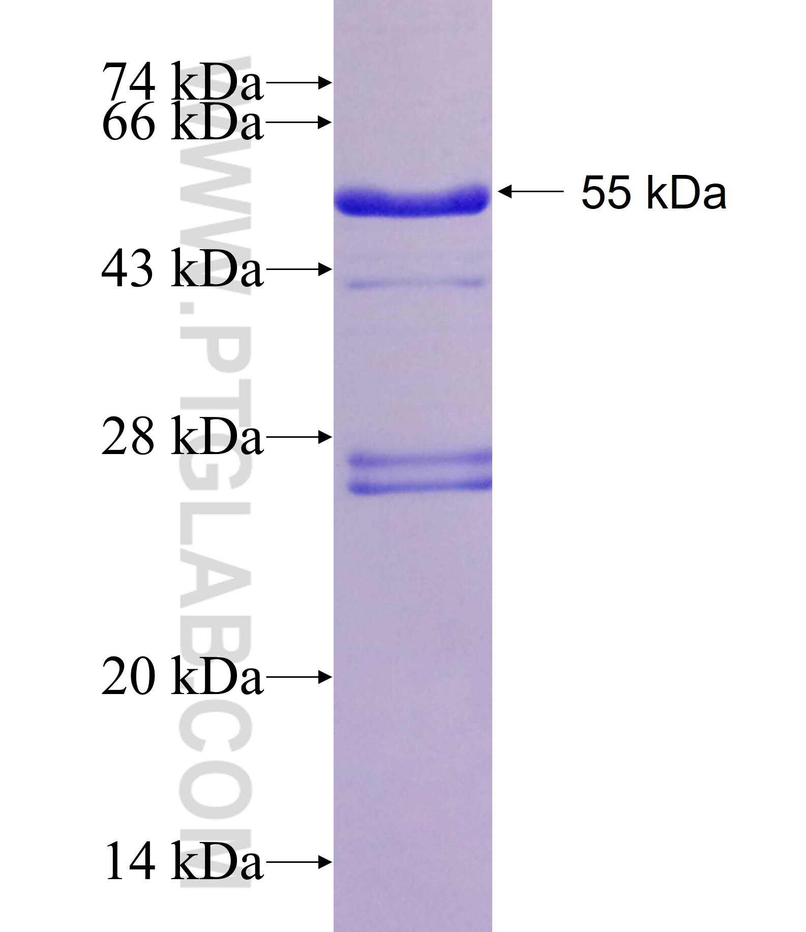 CCND2 fusion protein Ag1377 SDS-PAGE