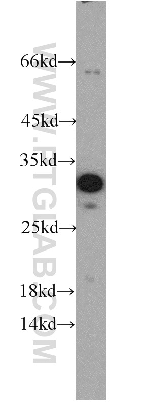 Western Blot (WB) analysis of MDA-MB-453s cells using Cyclin D3 Polyclonal antibody (10845-1-AP)