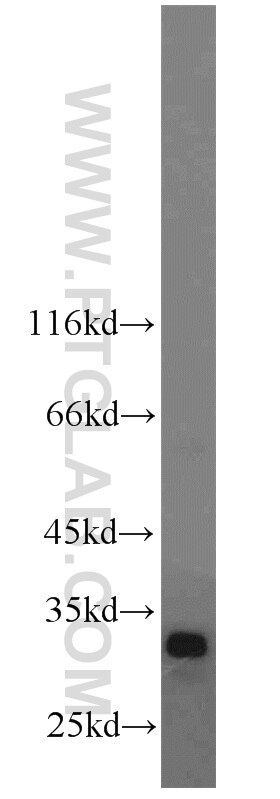 Cyclin D3 Polyclonal antibody