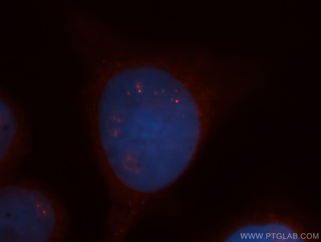 Immunofluorescence (IF) / fluorescent staining of HeLa cells using CCNDBP1 Polyclonal antibody (12363-1-AP)